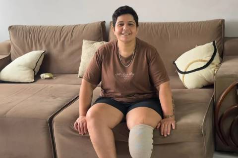 Após perder parte da perna por uma infecção rara, moradora de Criciúma busca apoio para recomeçar
