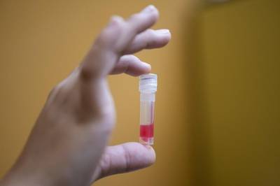 Testes de imunidade começam em alguns hospitais suíços