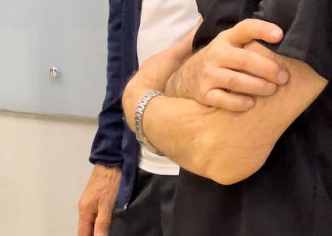 Criciúma: pesquisa investiga efeitos de produtos à base de cannabis em pessoas com Parkinson
