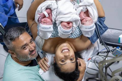 Hospital Nossa Senhora da Conceição registra nascimento de trigêmeas após acompanhamento especializado