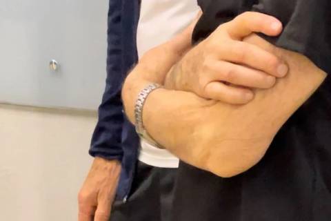 Parkinson: grupo segue recrutando voluntários para pesquisa em Criciúma