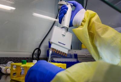 Primeiro caso de reinfecção por Covid-19 é confirmado laboratorialmente em Santa Catarina