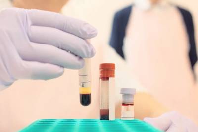 Urussanga credencia novos laboratórios e reforça o atendimento em exames de saúde