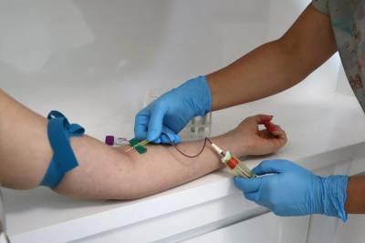 Laboratório Unimed Criciúma oferece 50% de desconto em exames aos domingos