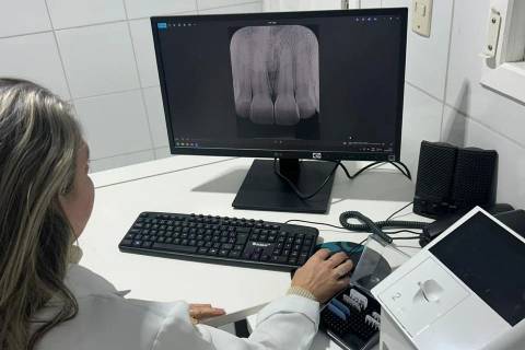 Cocal do Sul moderniza radiologia odontológica e reduz tempo de espera dos pacientes em até uma semana