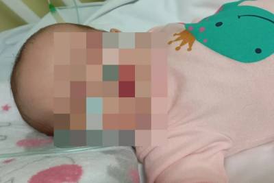 Criciúma: mãe de bebê relata sofrimento da filha e demora no diagnóstico da coqueluche