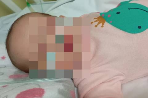Criciúma: mãe de bebê relata sofrimento da filha e demora no diagnóstico da coqueluche