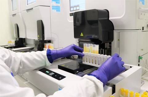 Unimed Criciúma passa a contar com sistema automatizado de última geração para exames de urina