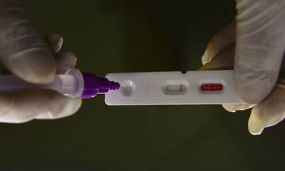 Brasil registra 27.796 casos de Covid-19 e 114 mortes em 24 horas