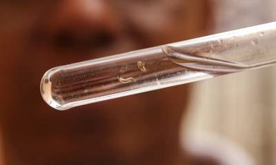 Brasil tem mais de um milhão de casos de dengue este ano 