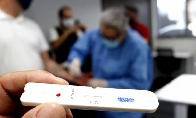 Estado envia testes rápidos aos municípios para ampliação da testagem contra Covid-19