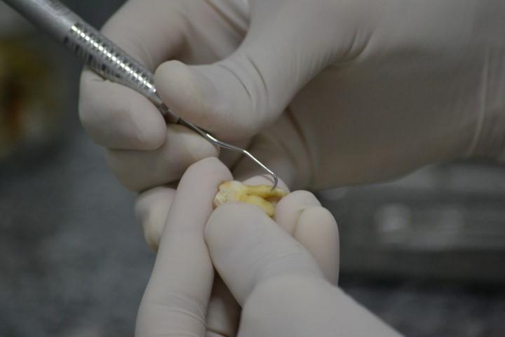 Banco de Dentes Humanos da Unesc auxilia nos estudos de acadêmicos de Odontologia