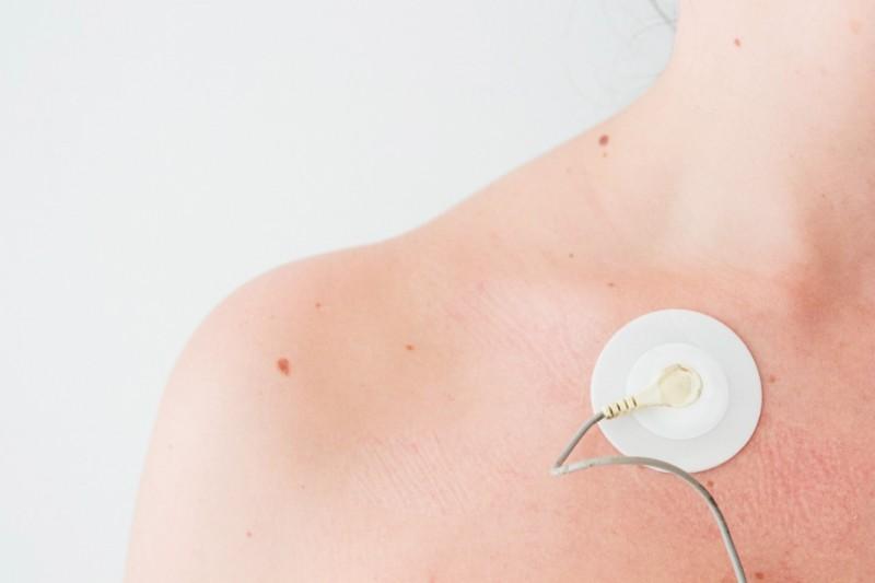 Eletrocardiograma: um aliado no diagnóstico das doenças cardíacas