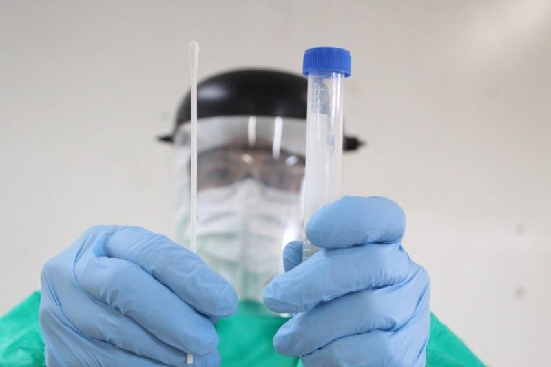 Covid-19: Criciúma registra mais 18 pessoas hospitalizadas nas últimas 24 horas