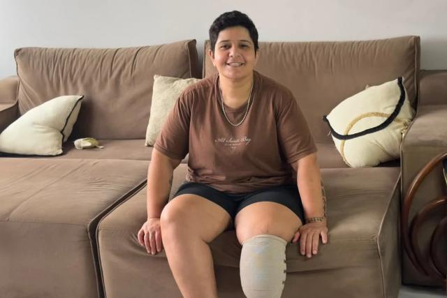 Criciumense organiza bazar solidário para custear prótese